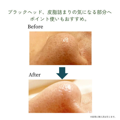 【公式】メリッサボーテ アミノクレンジングジェル150ml